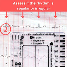 Load image into Gallery viewer, ECG 7 Step Ruler