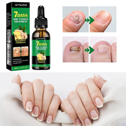 Ginger Nail Treatment